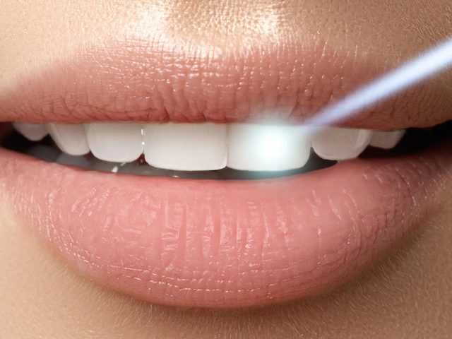 Aplicación de luz LED durante un blanqueamiento dental en clínica
